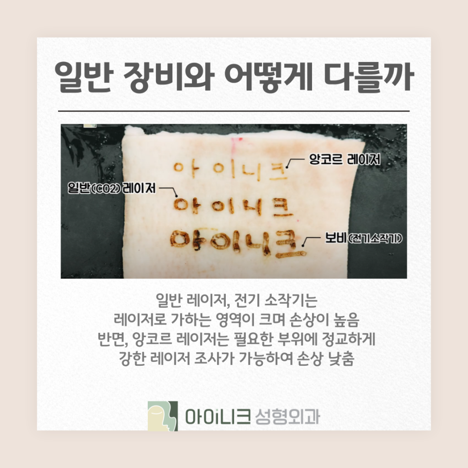 앙코르 눈밑지 효과 붓기 멍 적은 방법으로 관련 이미지 6