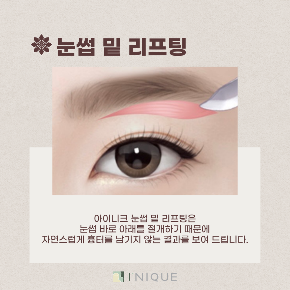 강남중년눈성형, 자신감의 비결 관련 이미지 4