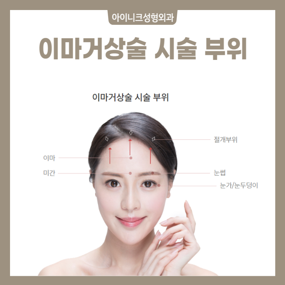 Forehead Lift Effect? If You’re with Iinic, There’s Nothing to Worry About image 2