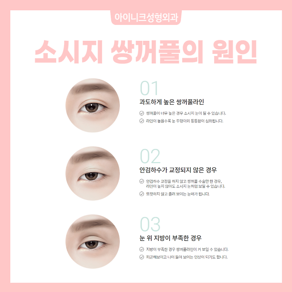 If You’re Curious About How to Succeed with Revision Surgery for a “Sausage Eye” image 2