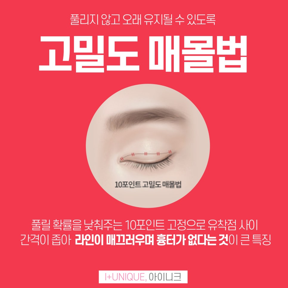 나에게 맞는 쌍꺼풀추천받고 싶다면 아이니크성형외과에서 관련 이미지 5