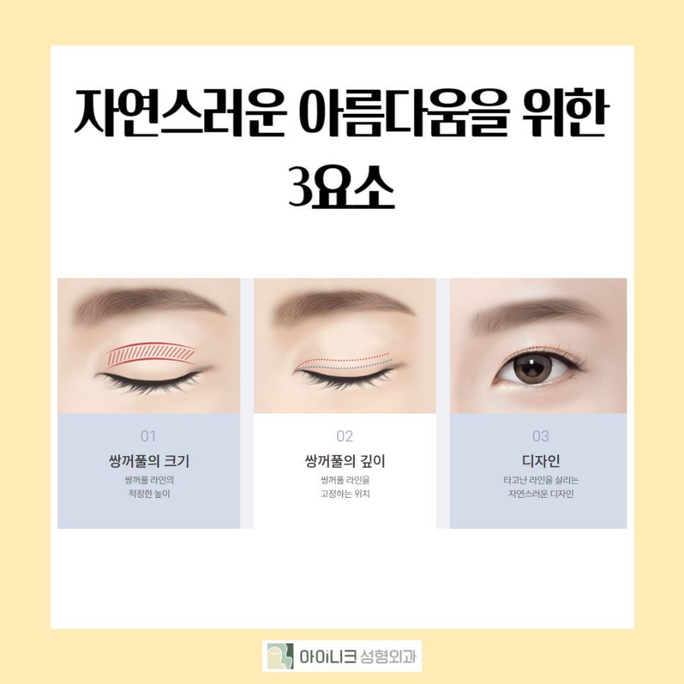 What Are the Reasons Double Eyelid Surgery Fails, and What Is the Right Revision Method? image 3