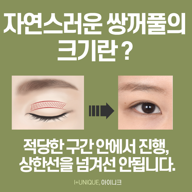서울에서 쌍꺼풀수술을 가장 잘하는 곳을 찾고 있다면? 클릭! 관련 이미지 3