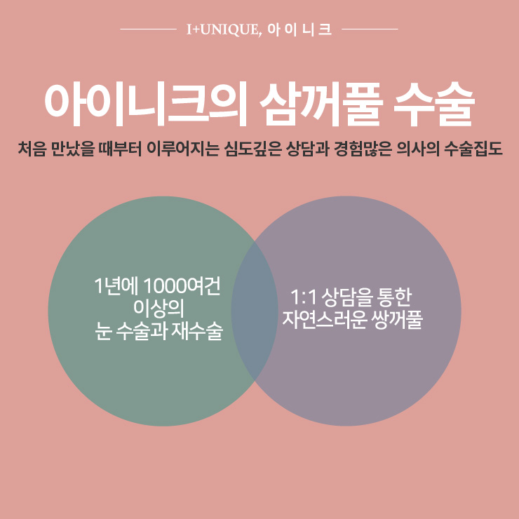 쌍꺼풀이 여러겹? ㅇㅇㄴㅋ에서  삼꺼풀 탈출하기 #1 관련 이미지 5
