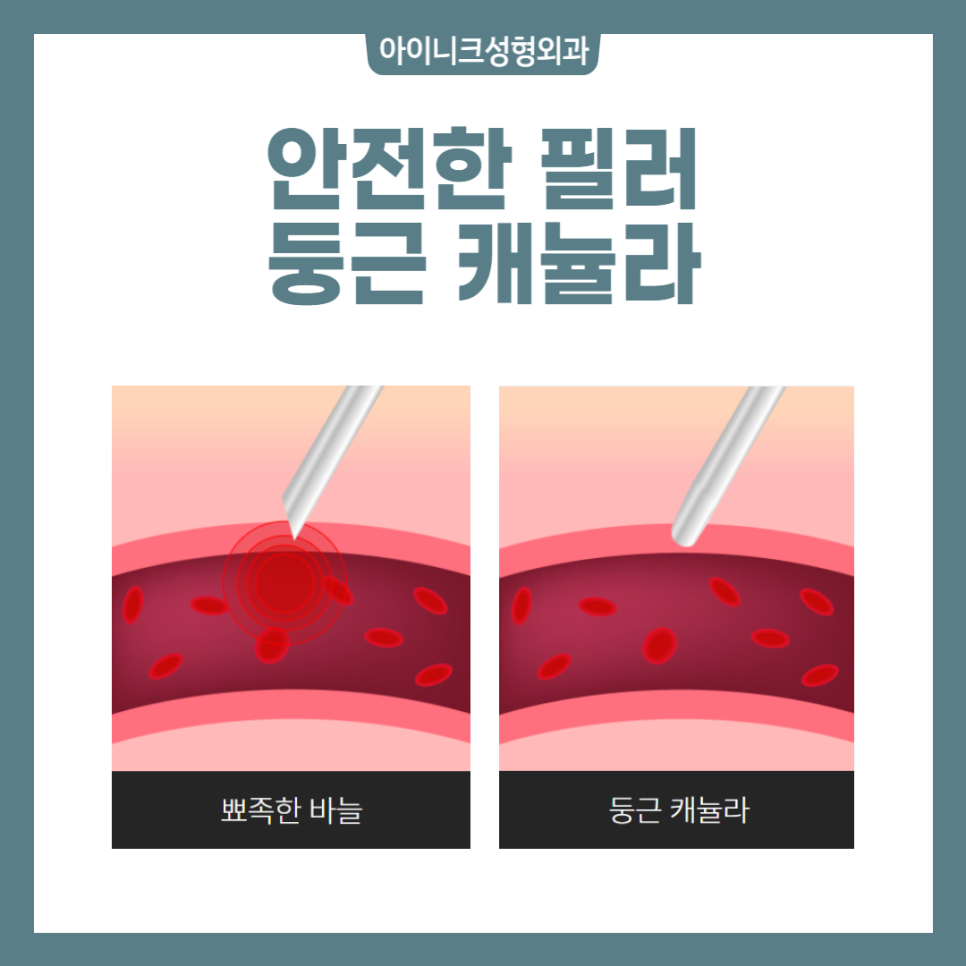 필러잘하는곳에서 간편하고 아름답게! 관련 이미지 4