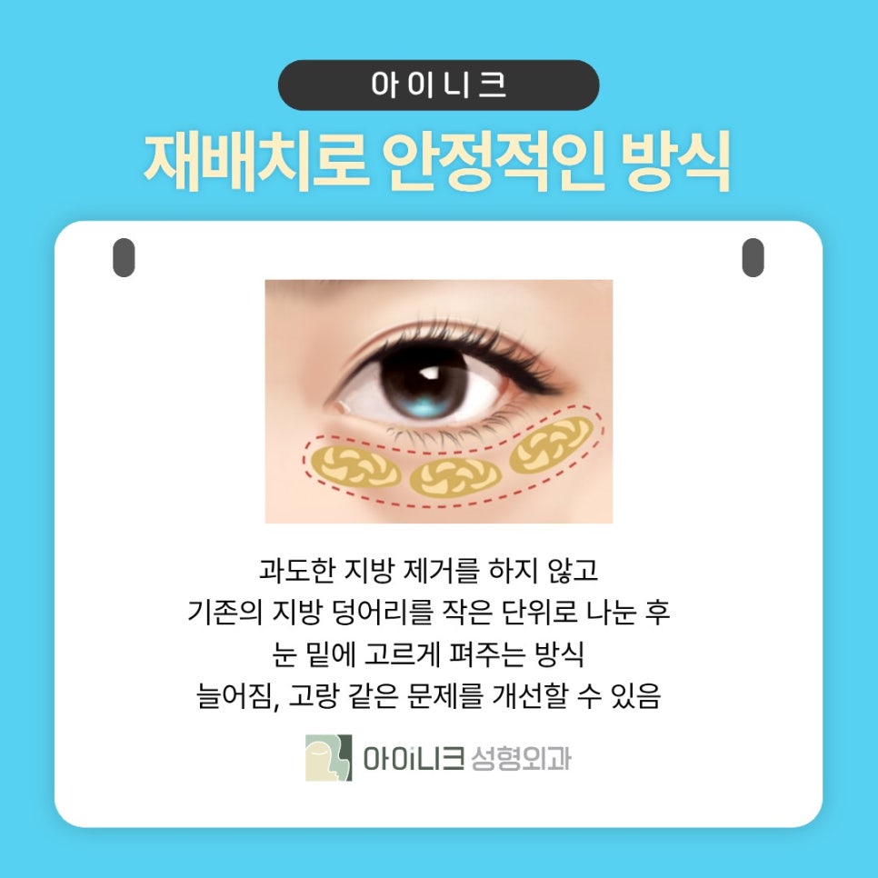 정상적인 구조를 파괴하지 않는 눈밑지방 시술 관련 이미지 4