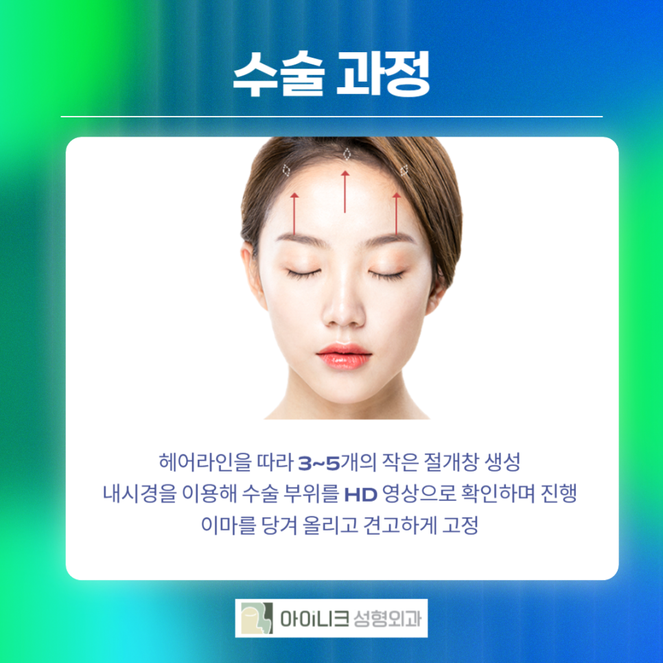 A Place Known for Excellent Forehead Lifts, Carefully Explained from the Basics image 3