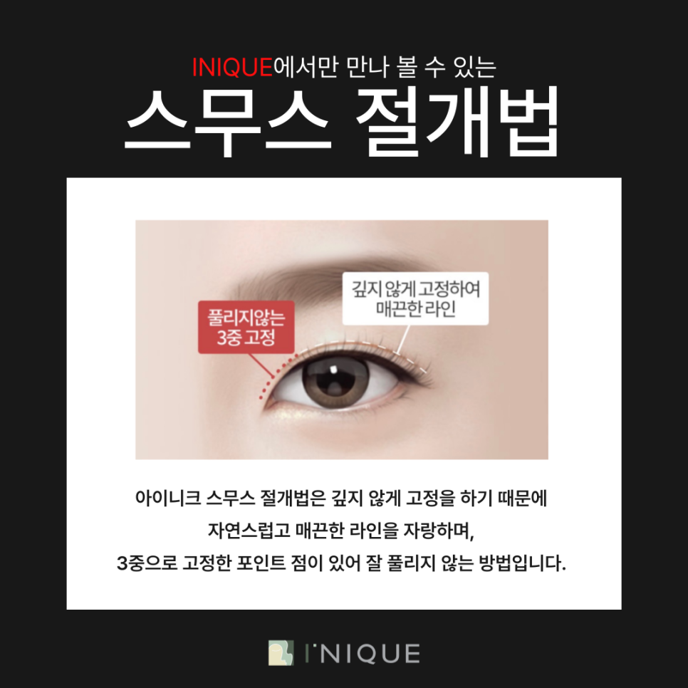 안전한 쌍수병원추천받고 싶다면 관련 이미지 4