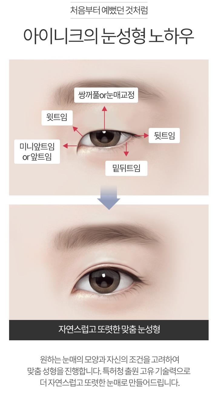 눈앞뒤트임 또렷한 눈매로 변신! 관련 이미지 2