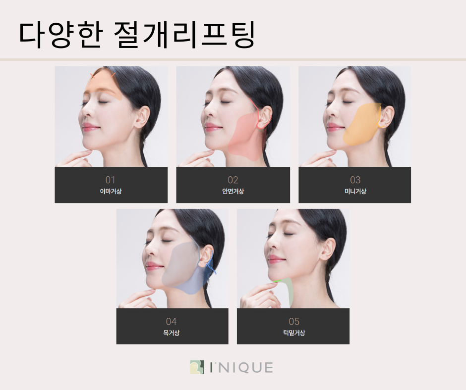 절개리프팅 종류 다양해요 관련 이미지 2