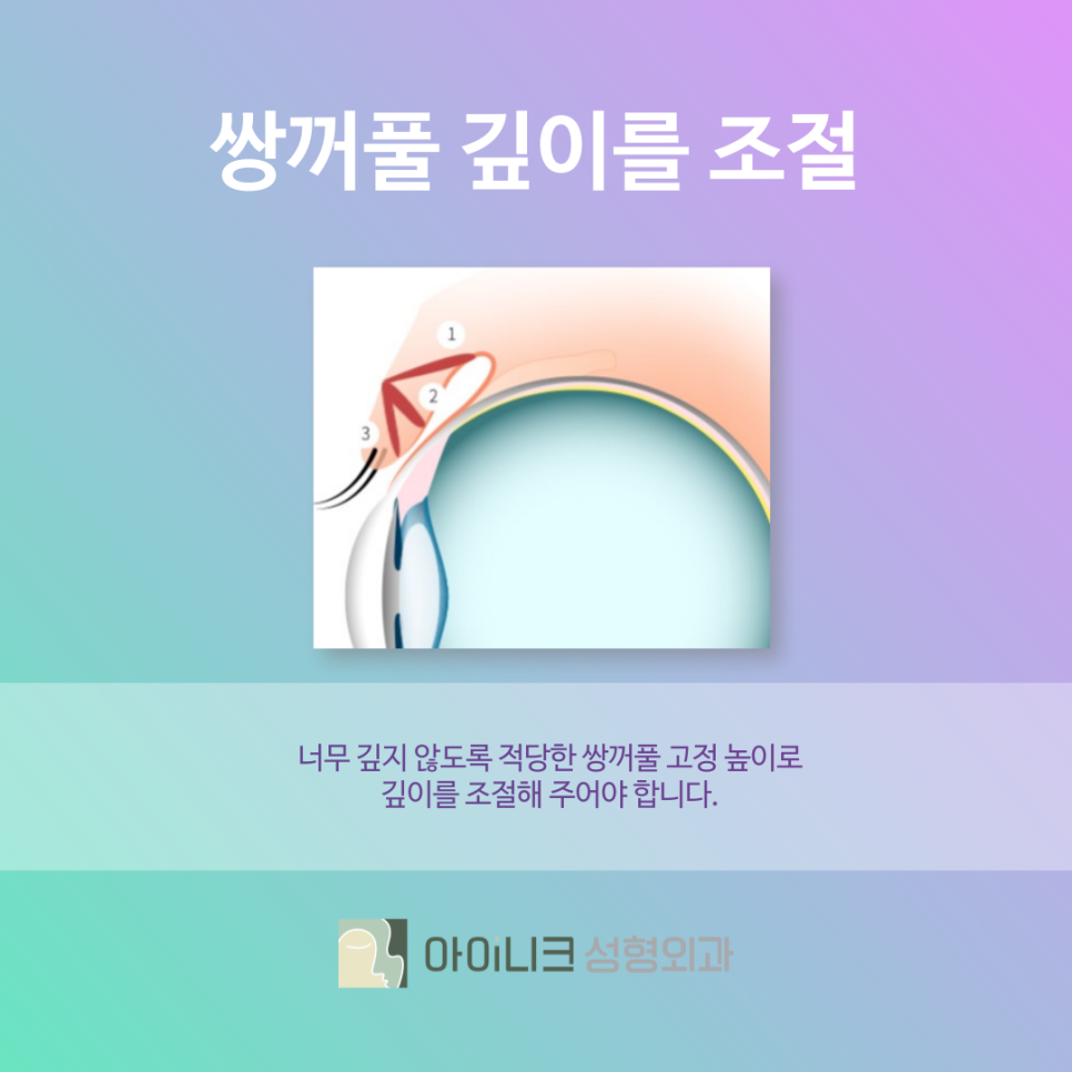 쌍수흉터 유형과 개선하는 방법 관련 이미지 7