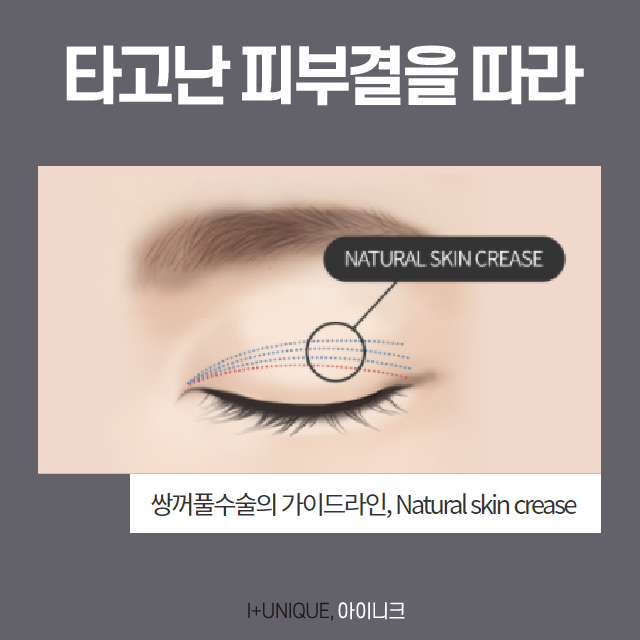 자연스러운 쌍꺼풀 만드는 비법은? 관련 이미지 5