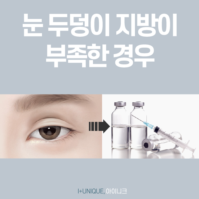실패 걱정은 이제 그만! 눈성형재수술, 한 번에 끝내자!! 관련 이미지 5