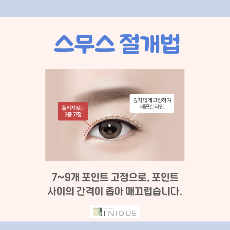 눈쌍꺼풀수술 나에게 맞는 수술은? 관련 이미지 2