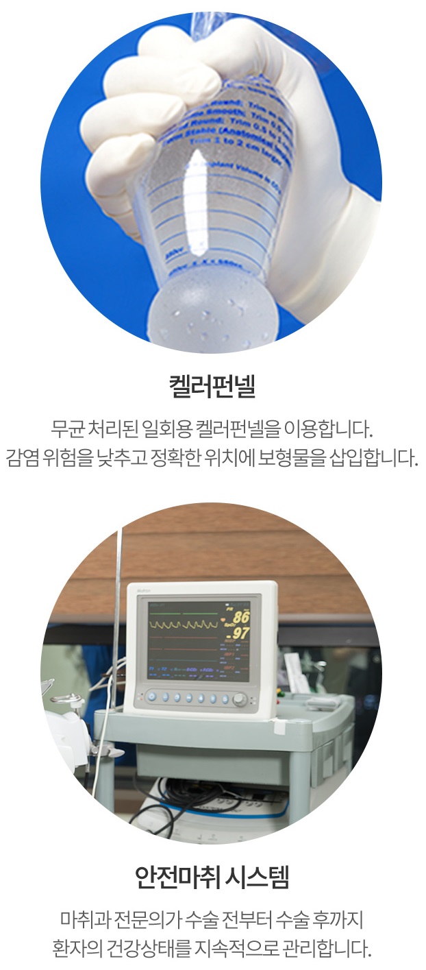 가슴성형주의사항 꼭 체크하세요! 관련 이미지 5