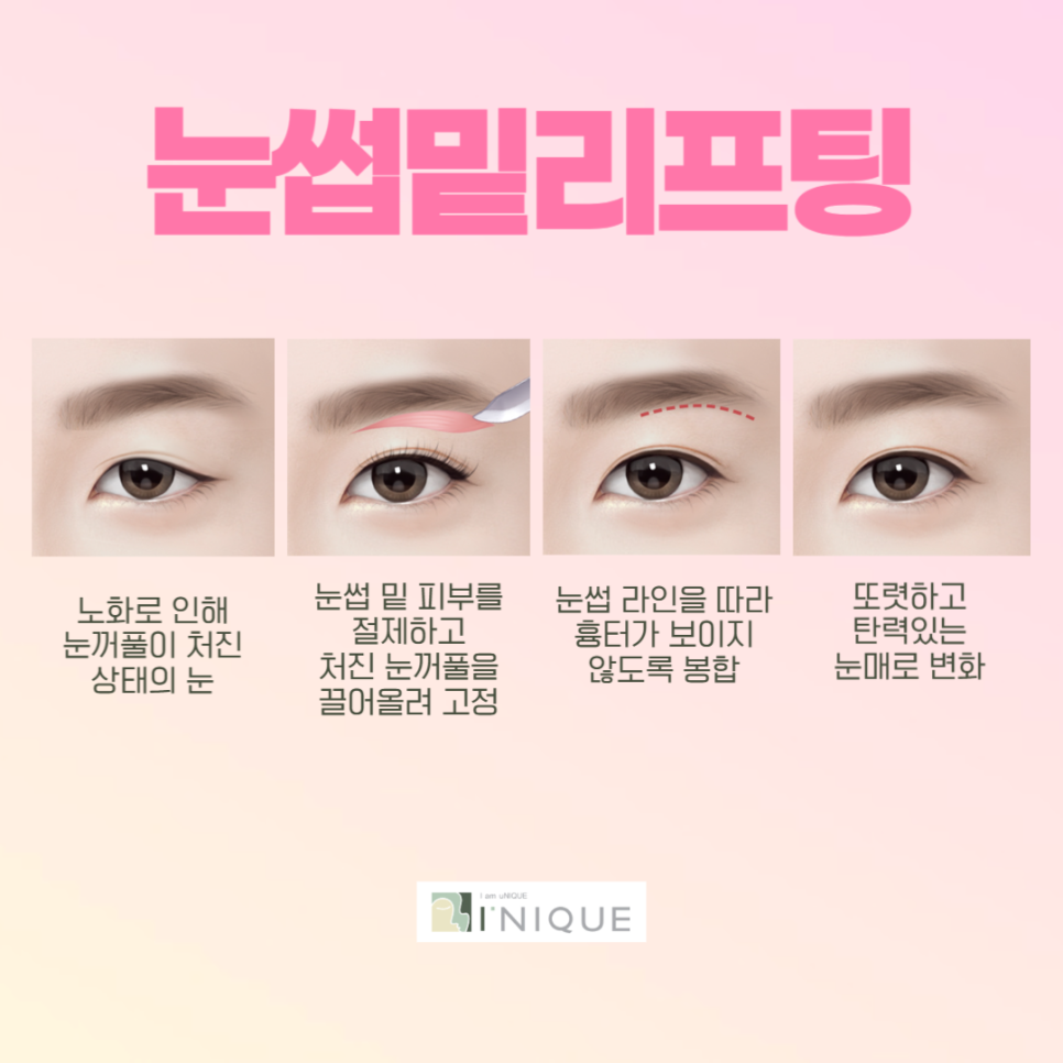 I-NIQUE, a Place Known for Good Middle-Aged Eye Surgery image 3