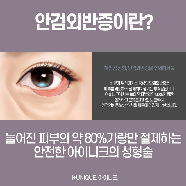 중년눈성형방법, 안전하고 완벽하게! 관련 이미지 5