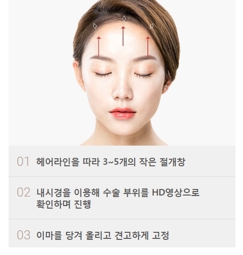이마거상술비용 맞춤 상담으로 꼼꼼하게 체크하세요! 관련 이미지 5