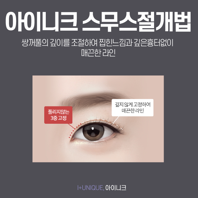 서울성형외과유명한곳, 내 눈을 정확하게 봐줄 수 있는 병원의 선택 관련 이미지 4