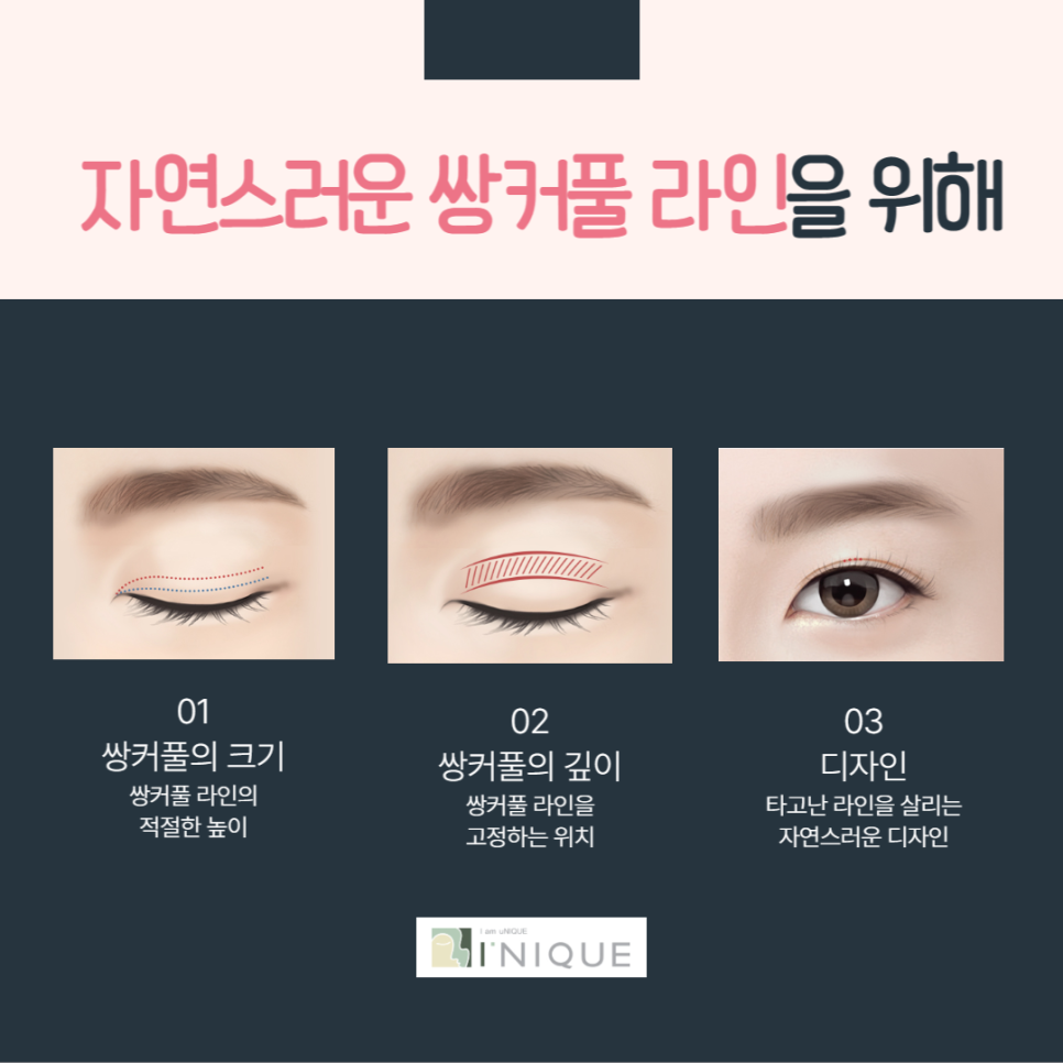 첫눈수술, 내 눈은 소중하니까! 관련 이미지 3