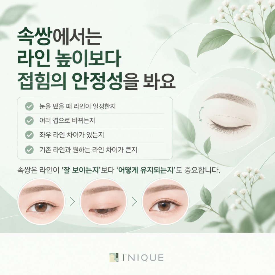 속쌍꺼풀 여자, 매몰법과 절개법은 어떻게 선택할까요? 관련 이미지 3