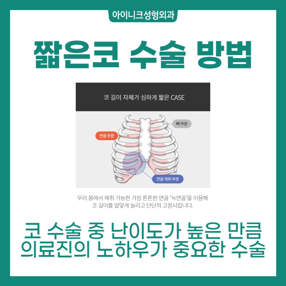 남자코수술전후 효과 확실하게 볼 수 있는 방법 관련 이미지 4