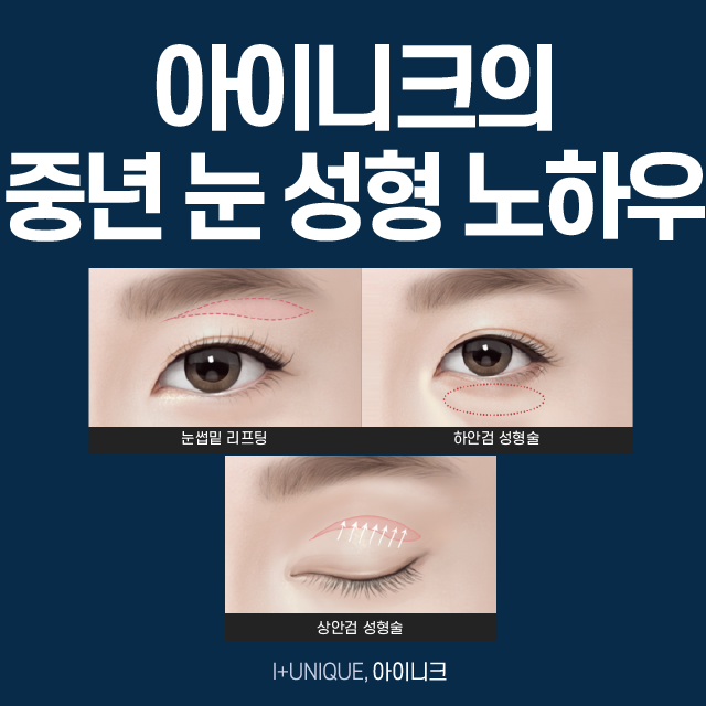 Middle-aged Eye Surgery: Rejuvenate with Minimal-Incision Lifting! image 2