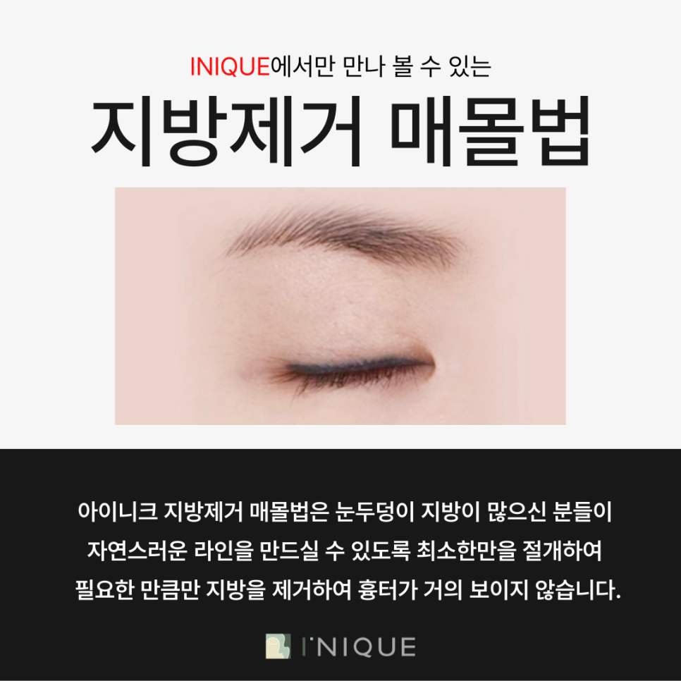 안전한 쌍수병원추천받고 싶다면 관련 이미지 6