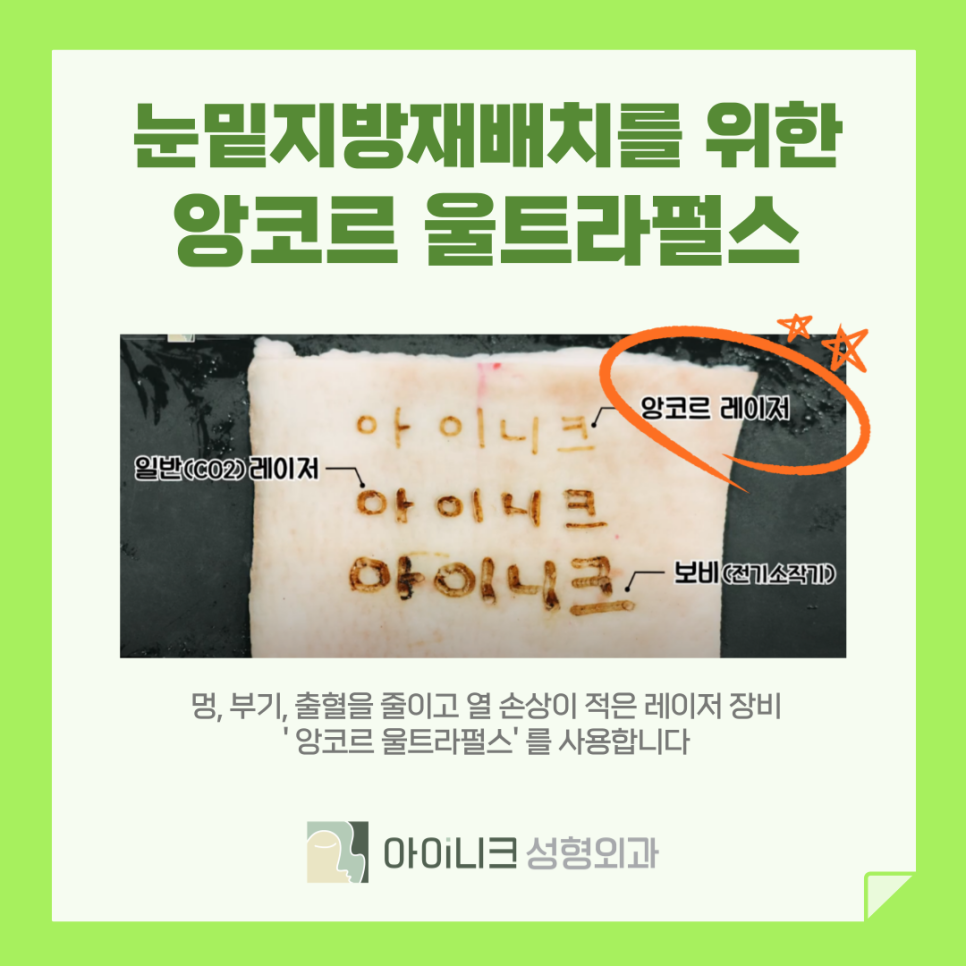 압구정 눈 밑 리프팅 눈밑지방재배치로 처진 주름 올려주기 관련 이미지 7