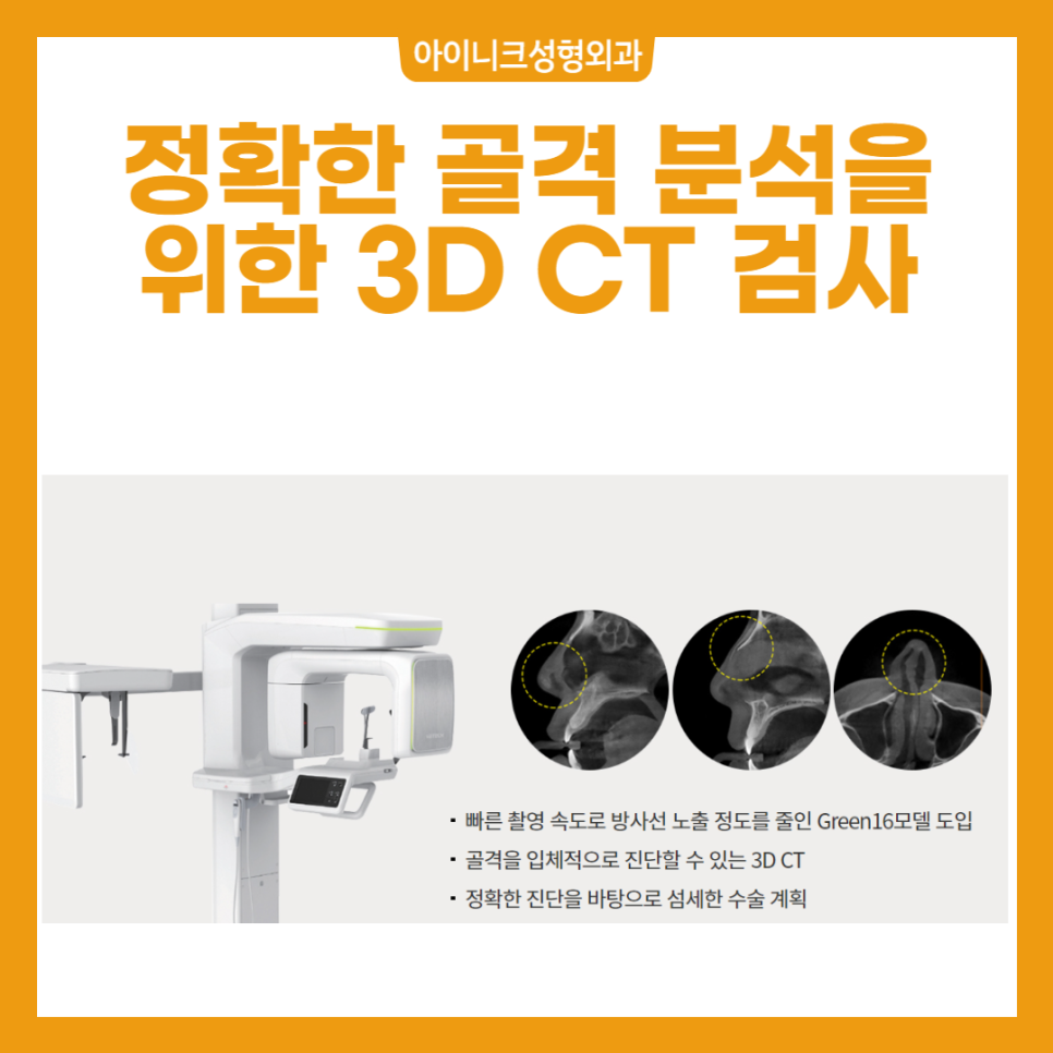 남자코성형후기 모음 - 낮은 코, 매부리코, 미간꺼짐 개선 효과를 확인해보세요 관련 이미지 4