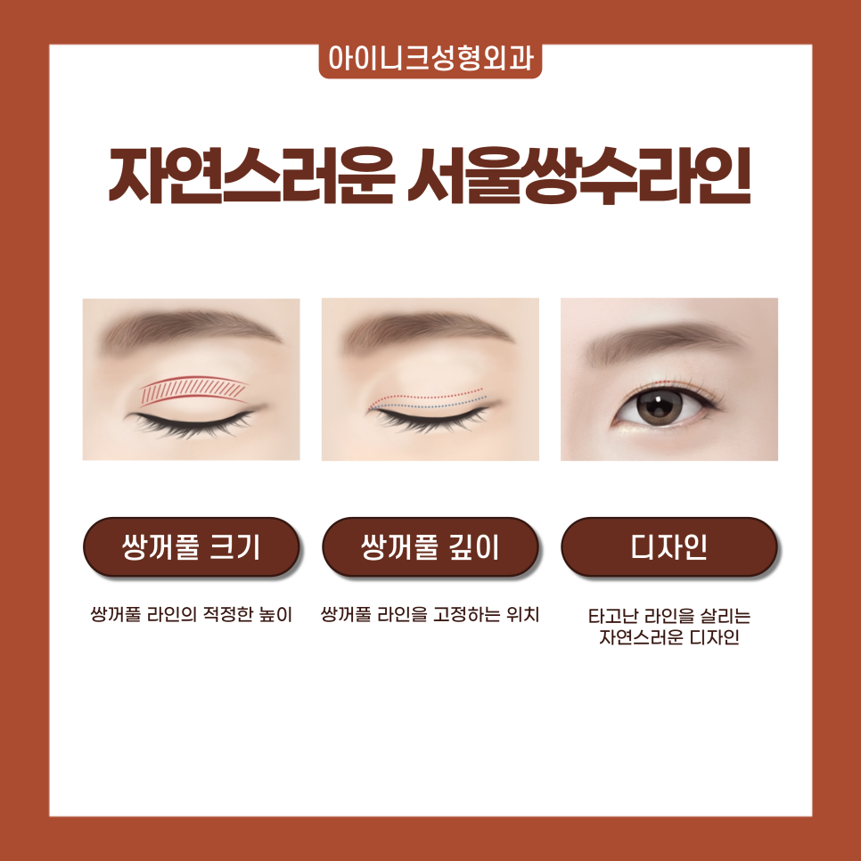 서울 쌍수 라인으로 자연스럽게! 관련 이미지 2