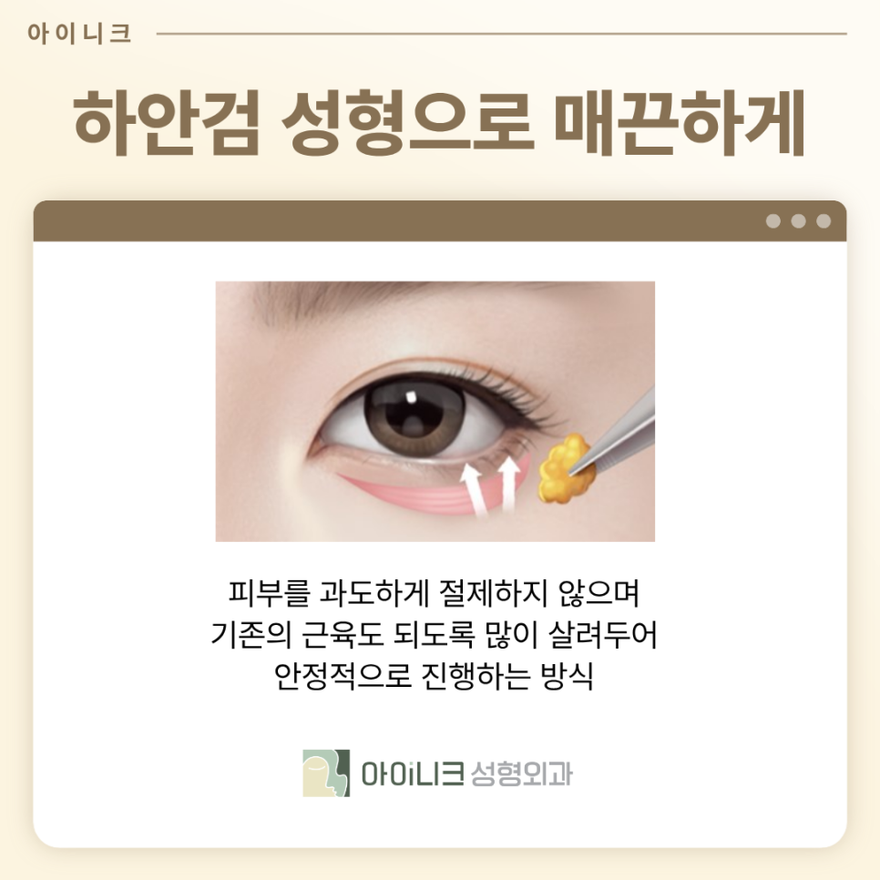 눈밑지방재배치성형외과 칙칙한 다크서클 어떻게 교정할까? 관련 이미지 6
