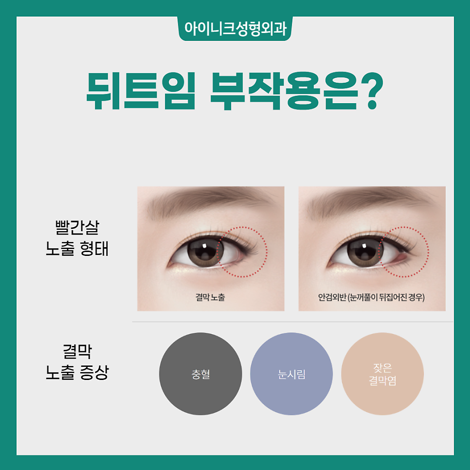 뒤트임잘하는곳 찾고 있나요? 관련 이미지 4