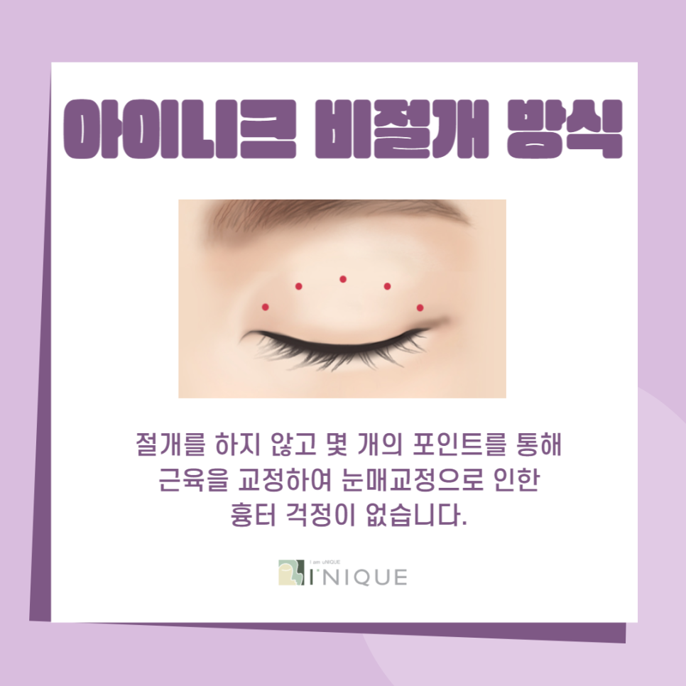 남자짝눈교정, 더 자연스럽고 또렷하게! 관련 이미지 5