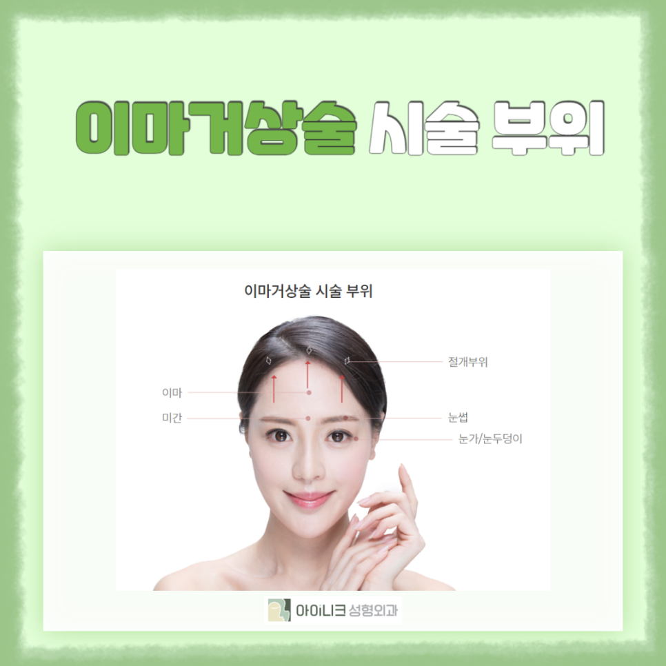30대이마거상술로 깨끗한 이마 만들기 관련 이미지 4