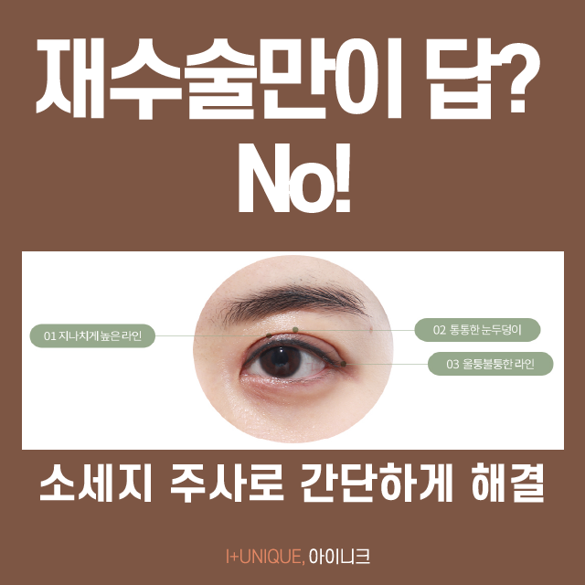 Can Swelling After Double Eyelid Surgery Be Fixed Only with Reoperation? Now It Can Be Done Easily with a “Sausage Injection”! image 2