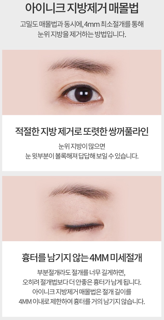 티안나는쌍수 아이니크의 노하우로! 관련 이미지 6