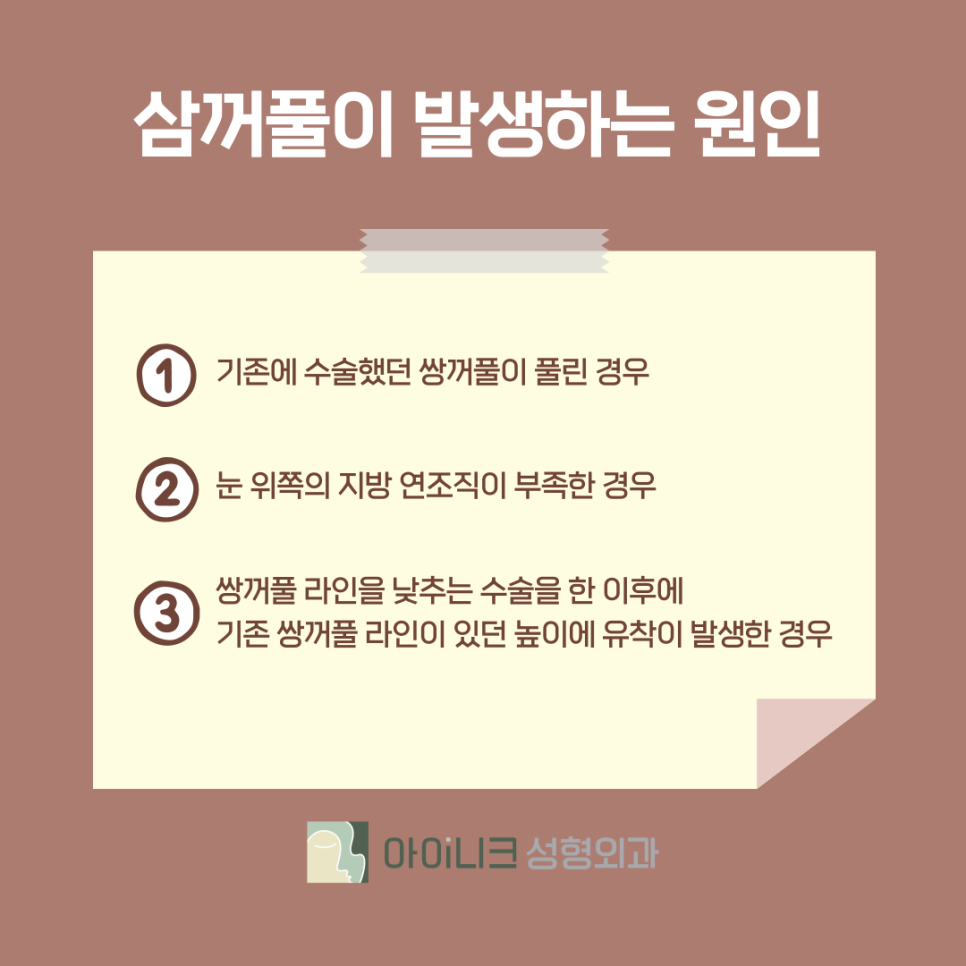 쌍수절개재수술 3중 고정으로 견고하게 관련 이미지 6