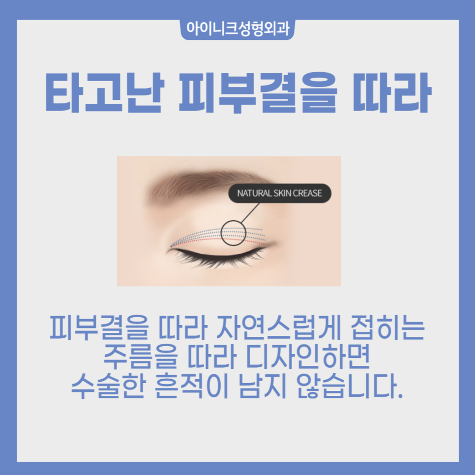 Male Eye Surgery Clinic: Natural and Refined Eye Shape image 4
