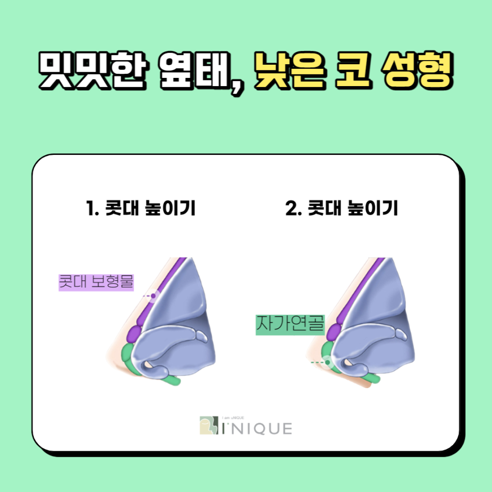 여자코성형후기가 증명하는 아이니크 관련 이미지 4