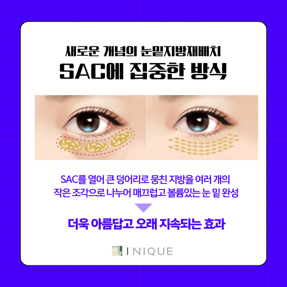 강남 눈밑지방재배치, 멍 들까봐 고민된다면? 관련 이미지 7