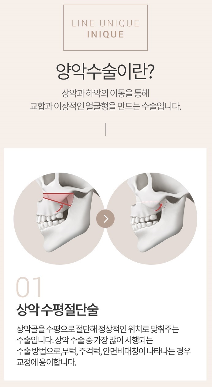 양악수술회복기간 고민 없는 아이니크에서! 관련 이미지 2