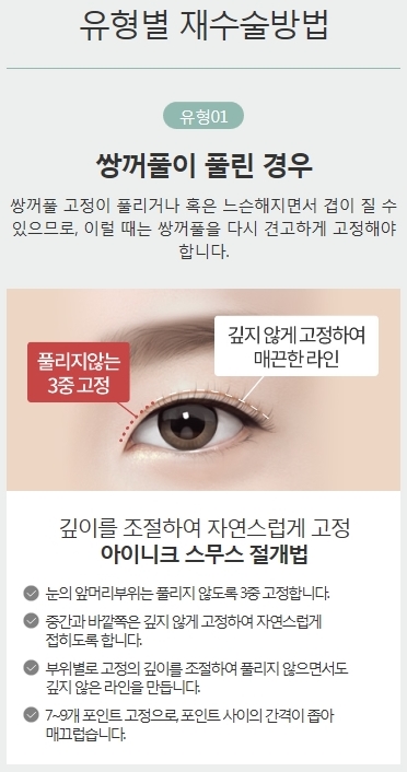 풀린쌍꺼풀 여러 겹의 쌍꺼풀 개선하는 방법! 관련 이미지 3