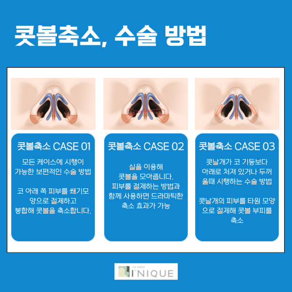 콧볼축소잘하는병원, 여기있어요! 관련 이미지 3