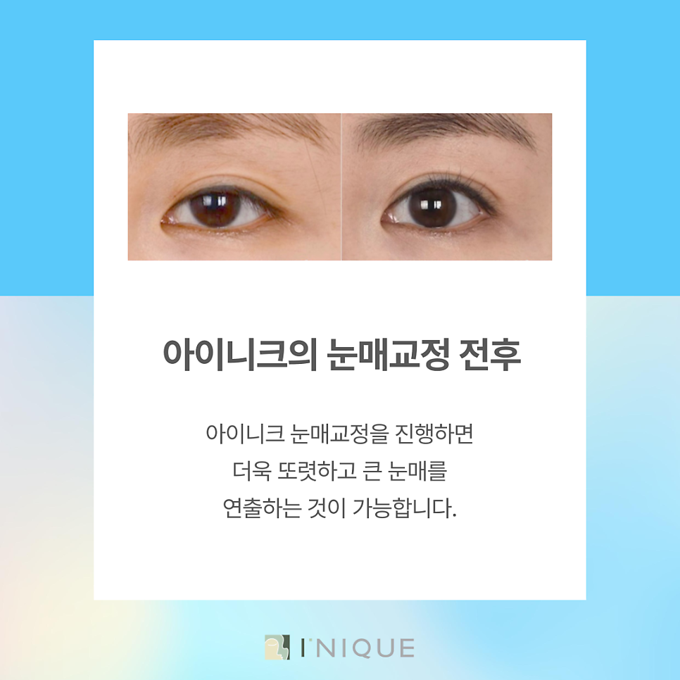 Eyelid Correction Near Gangnam Station at Inique image 4