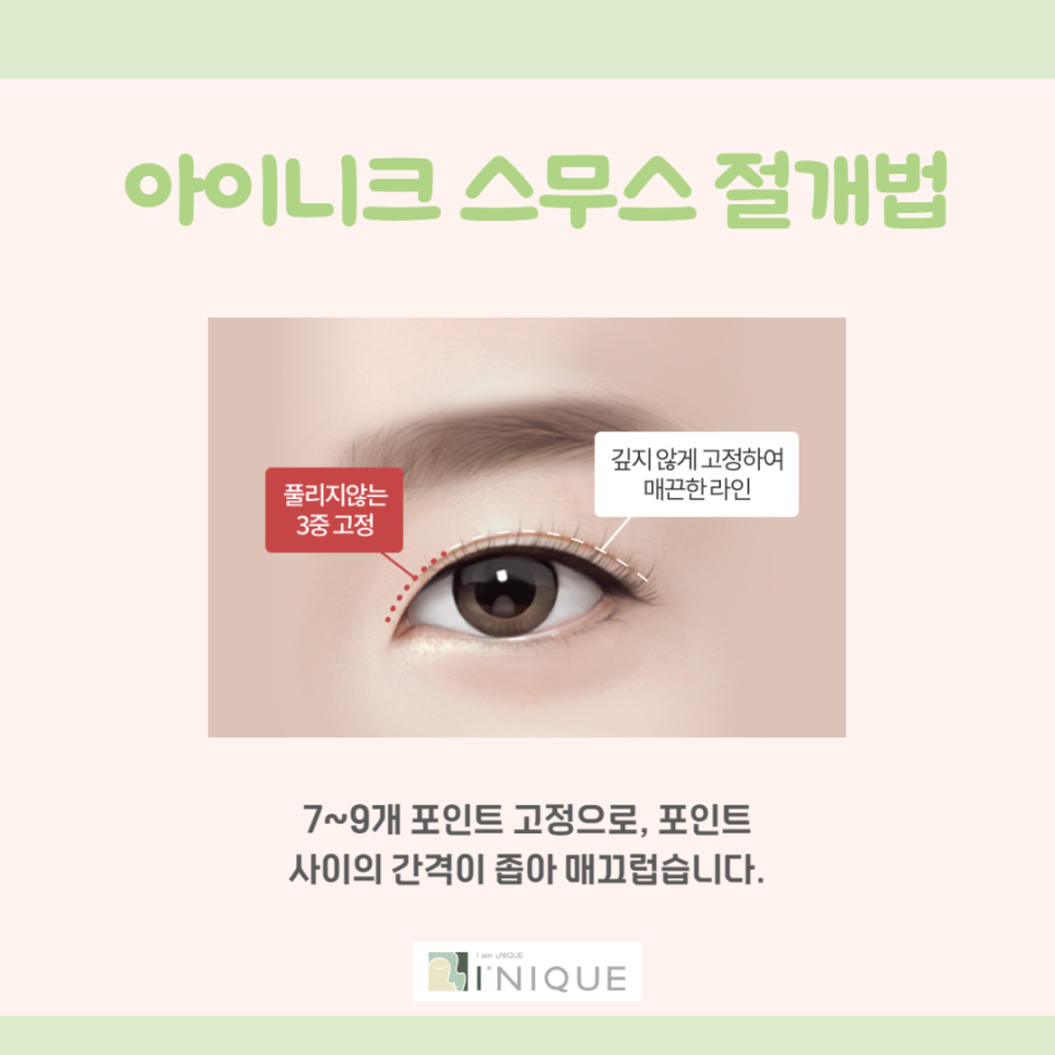 쌍꺼풀만들기 고민하고 계신가요? 관련 이미지 3