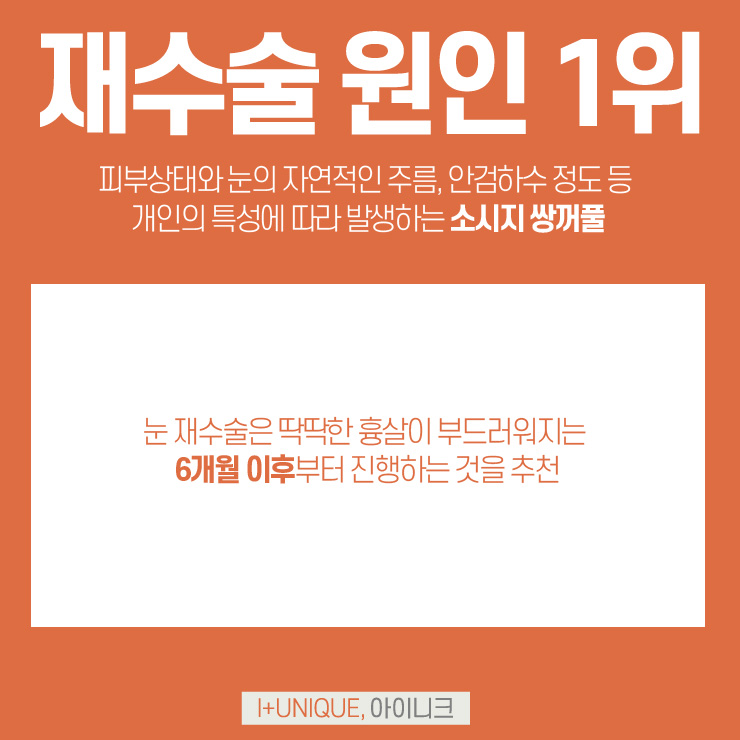 쌍수잘하는병원 아이니크성형외과 관련 이미지 2