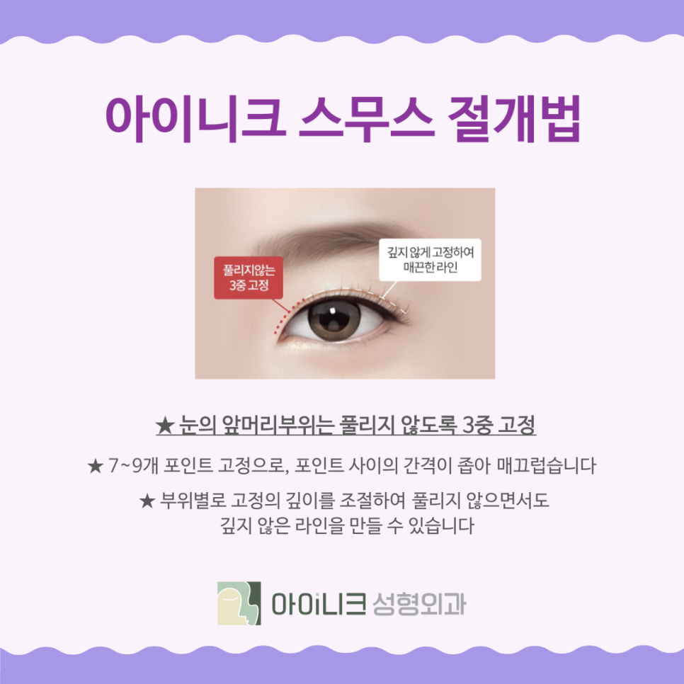 강남눈수술 쌍꺼풀은 자연스러운 디자인이 중요 관련 이미지 7