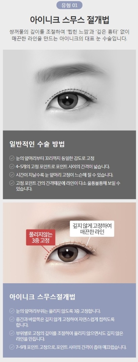 연예인쌍커풀 같은 자연스럽고 또렷한 눈매를 원한다면! 관련 이미지 4
