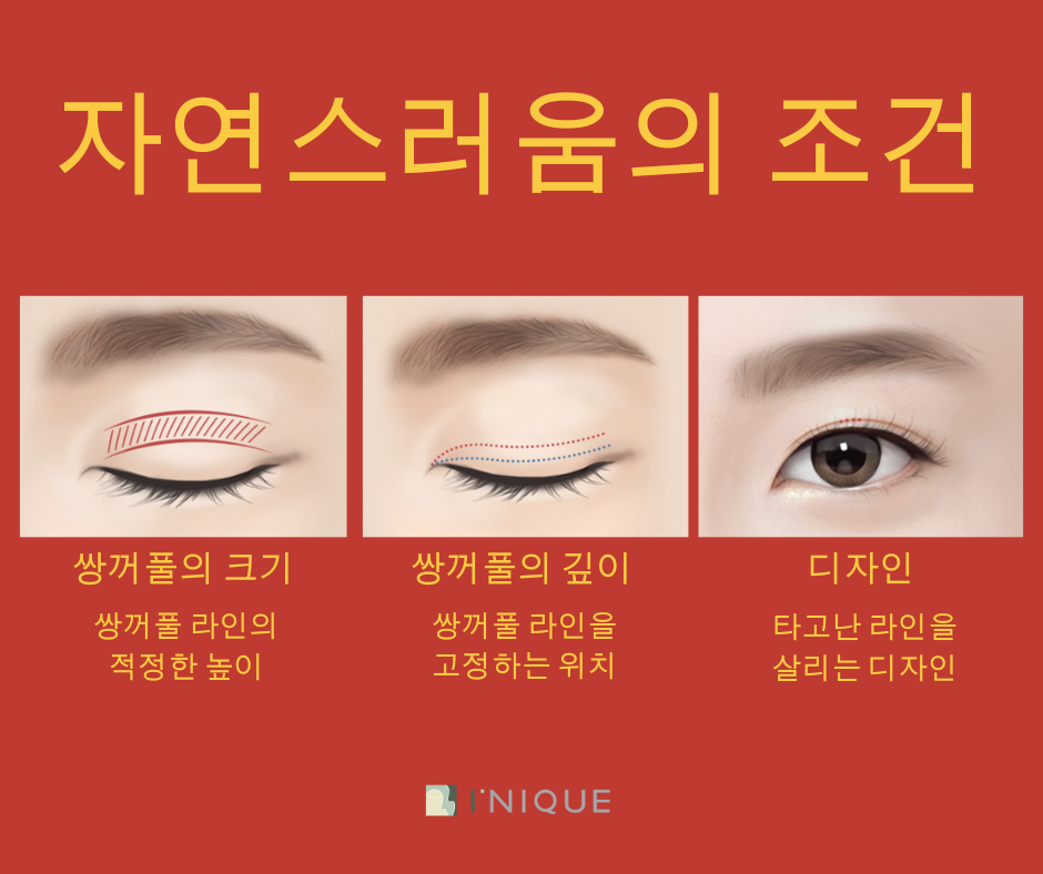 쌍꺼풀잘하는곳 찾는다면? 관련 이미지 4